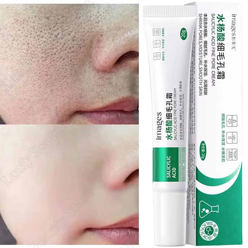 Salicylic Acid Blackhead Remover - Krem z kwasem salicylowym do oczyszczania